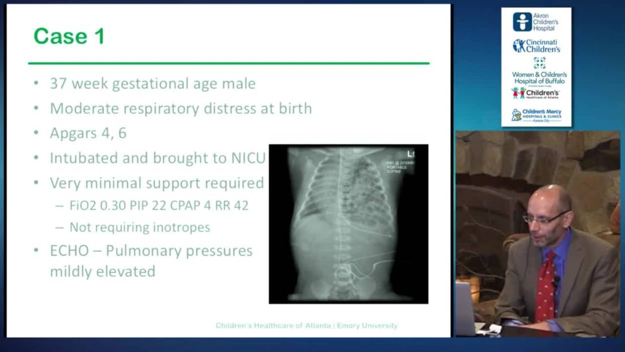 CDH-ECMO Routine Patient Preoperative Workup, Timing, Technique: Update...