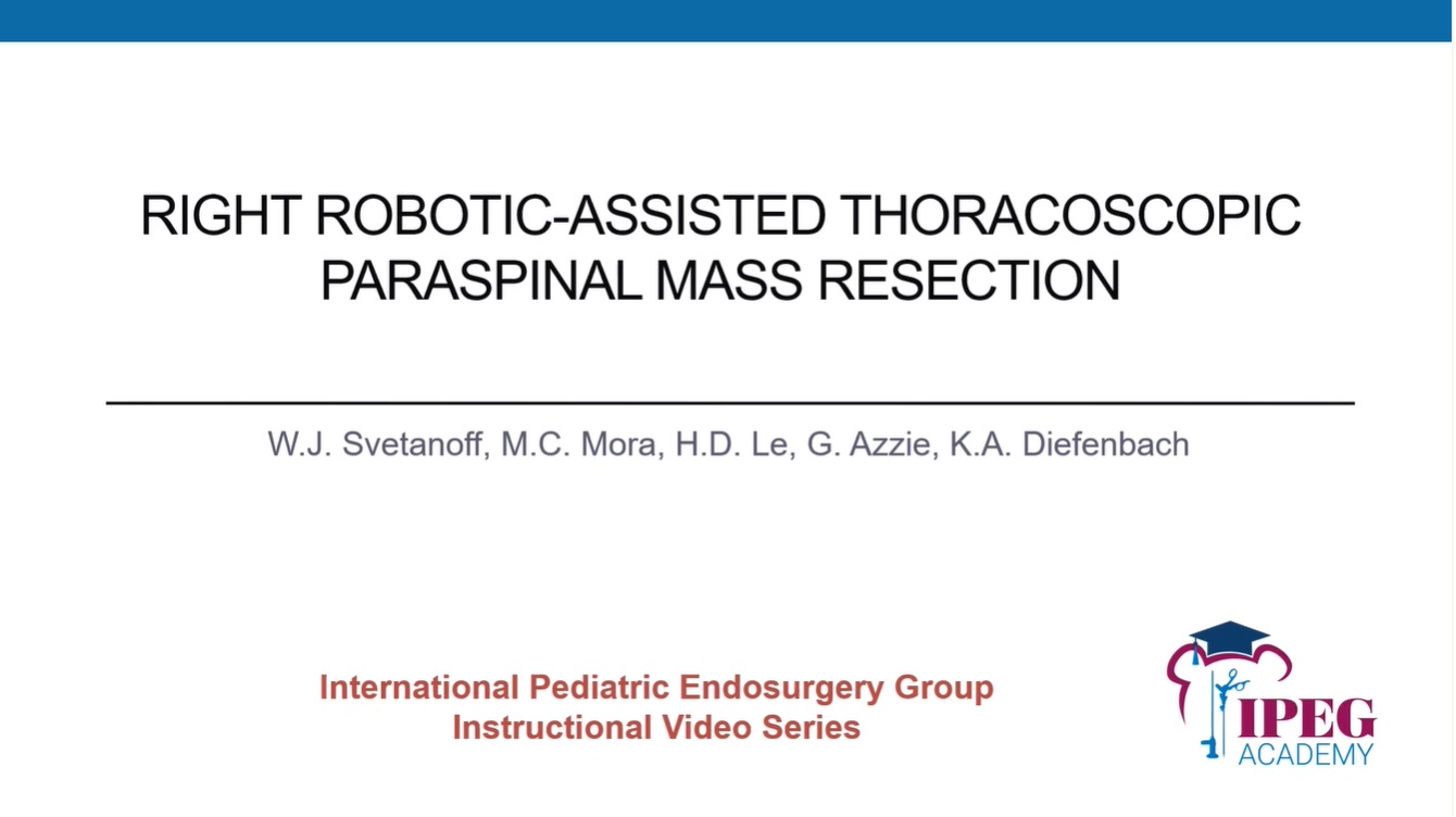IPEG Academy: Right Robotic-Assisted Thoracoscopic Paraspinal Mass Resection
