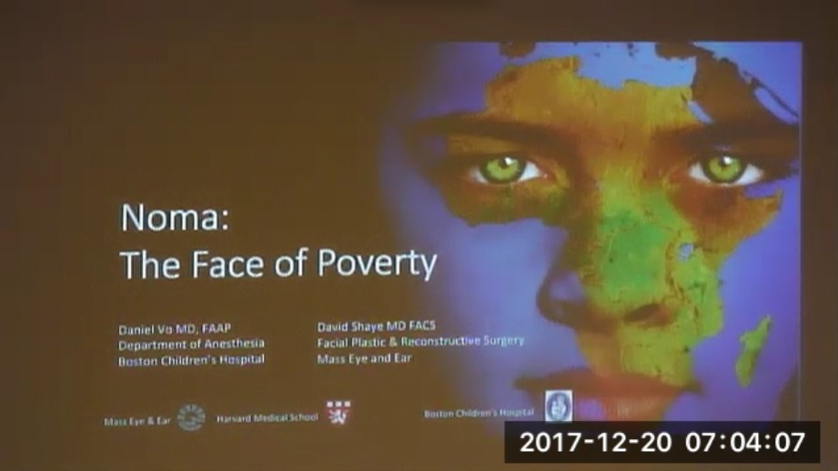Dr. Daniel Vo and Dr. David Shaye - Noma: The Face of Poverty