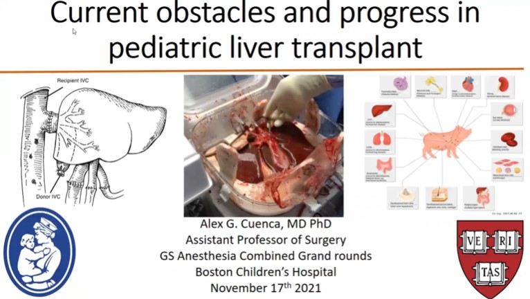 Dr. Alex Cuenca - Current Obstacles and Progress in Pediatric Liver Transplant