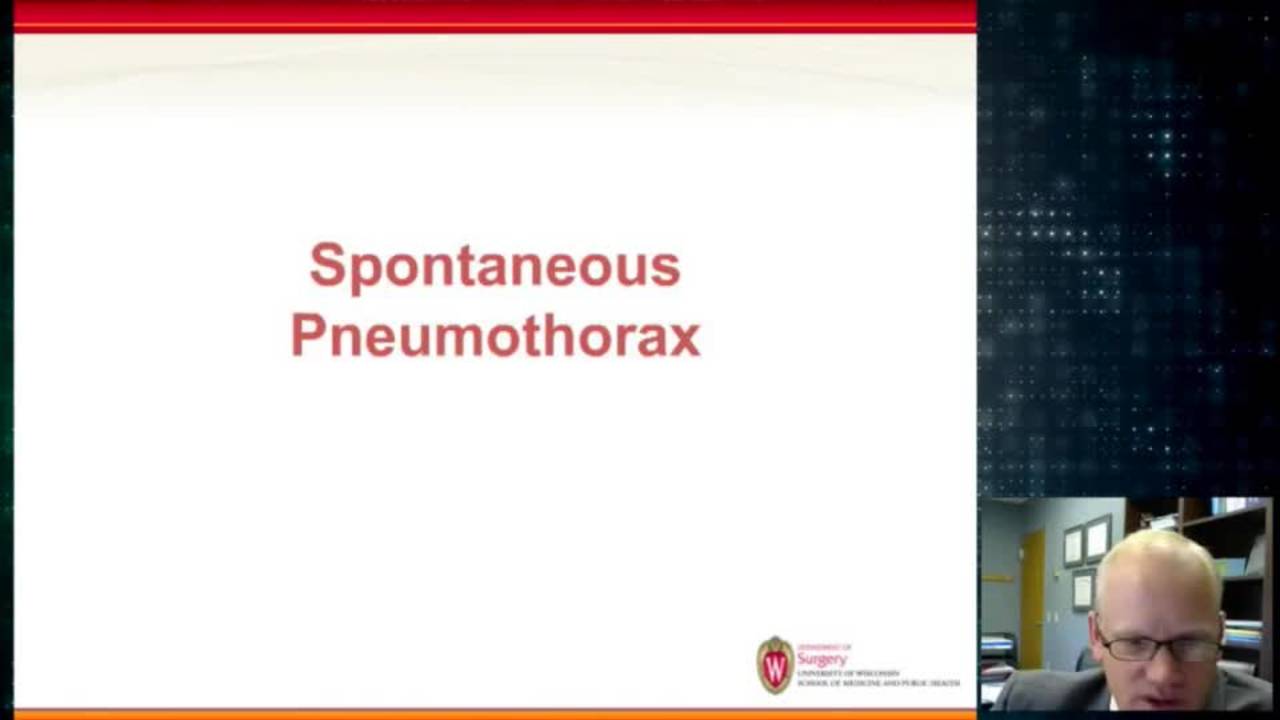 Spontaneous Pneumothorax: Update Course 2014
