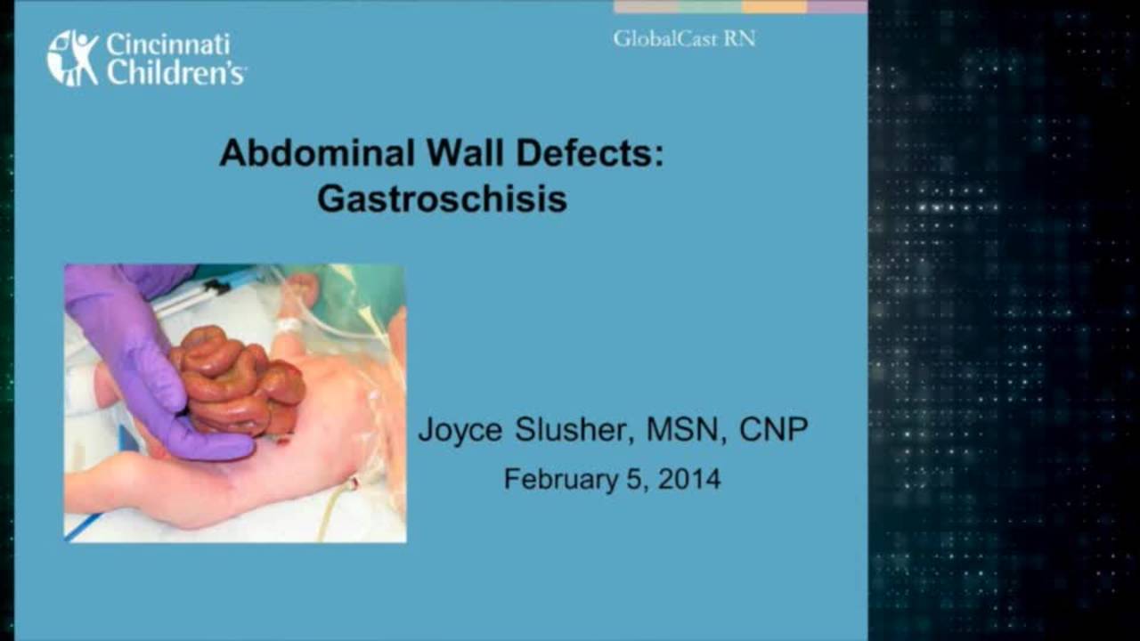 Gastroschisis: Advanced Practice Providers