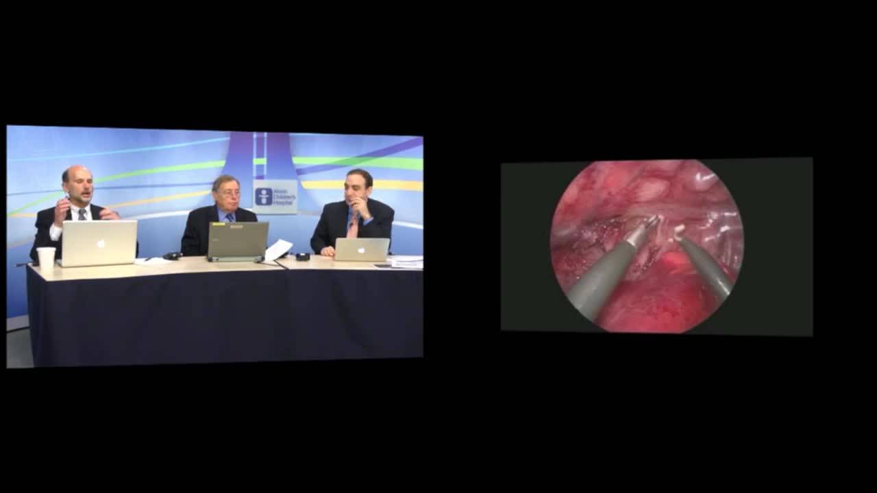 Rothenberg Thoracoscopic Technique Video: EA/TEF