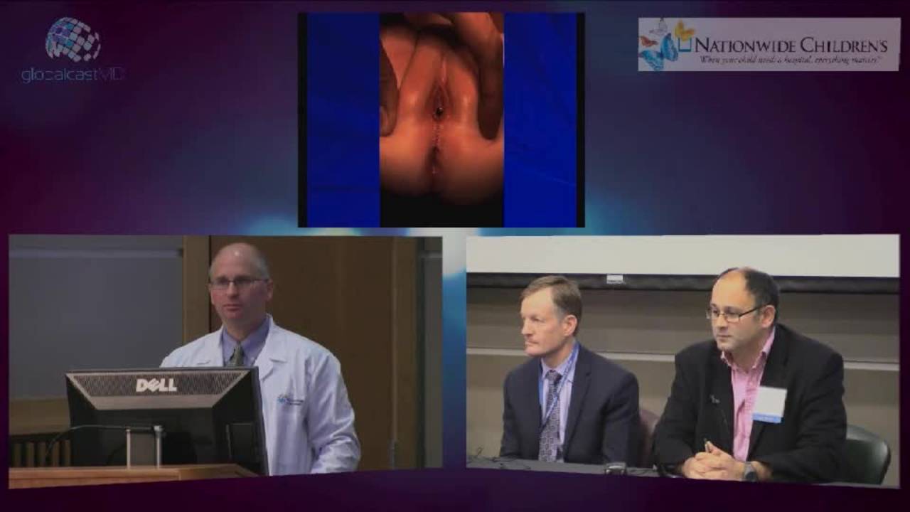Anorectal Malformation Management of Female Patients Part II: Pediatric...
