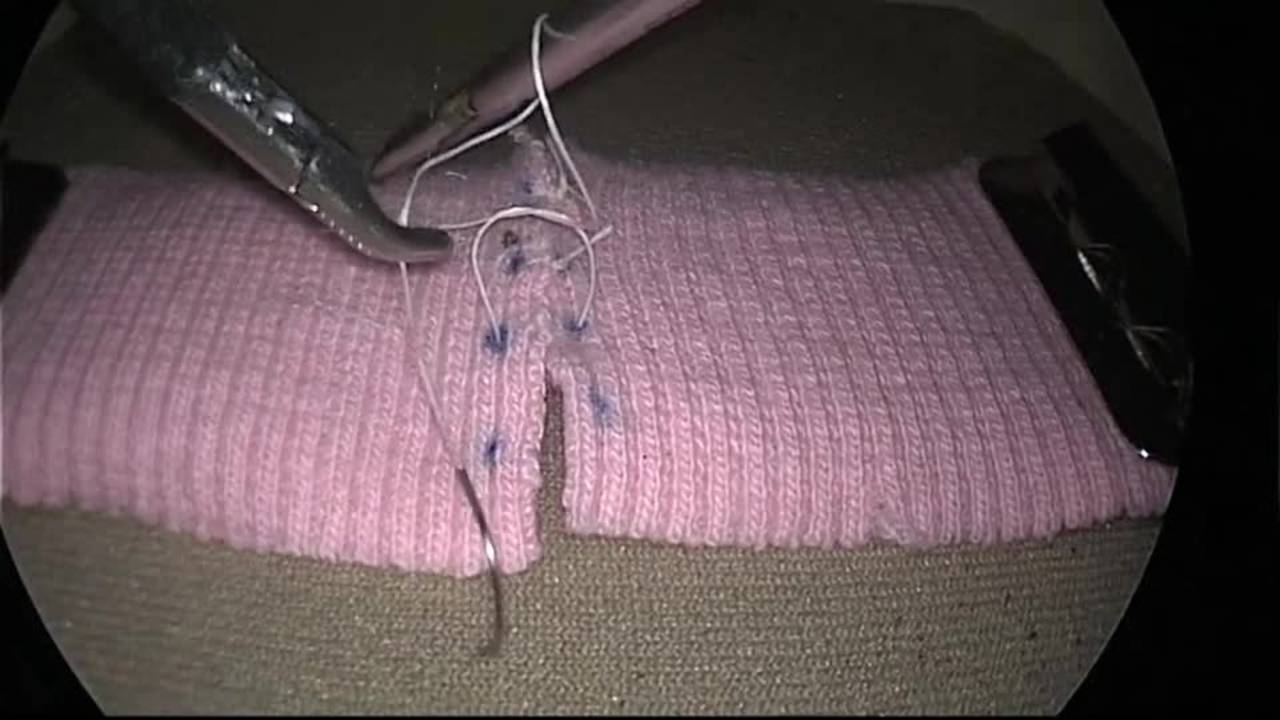 Diefenbach Lap Sliding Knot