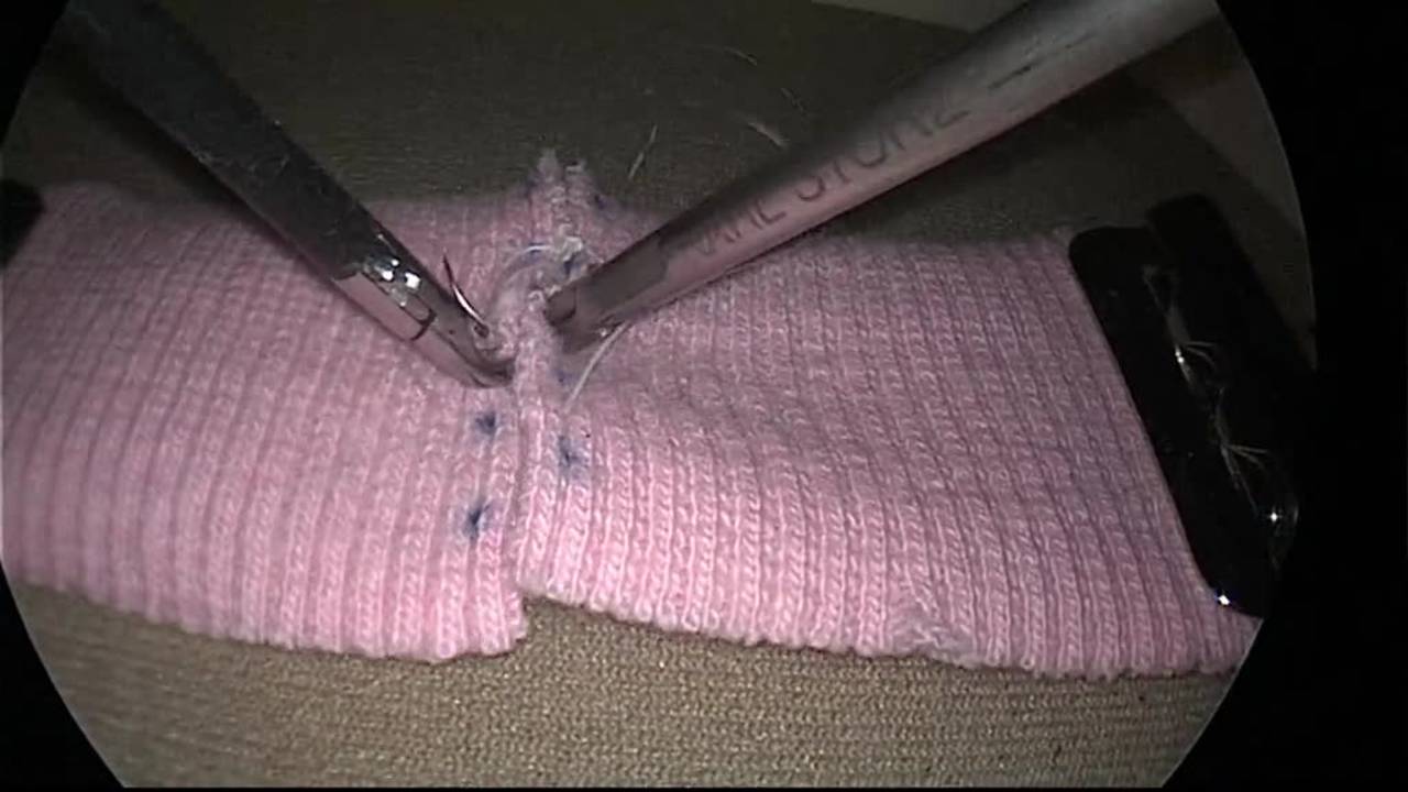 Laparoscopic Knot Tying