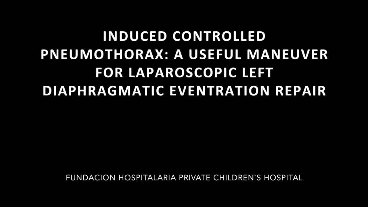 Induced, Controlled, Pneumothorax: A Useful Maneuver For Laparoscopic Left...