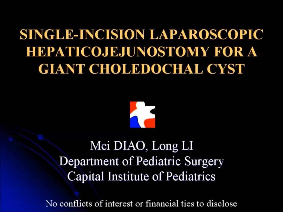Single Site Laparoscopic Hepaticojejunostomy For Giant Choledochal Cyst