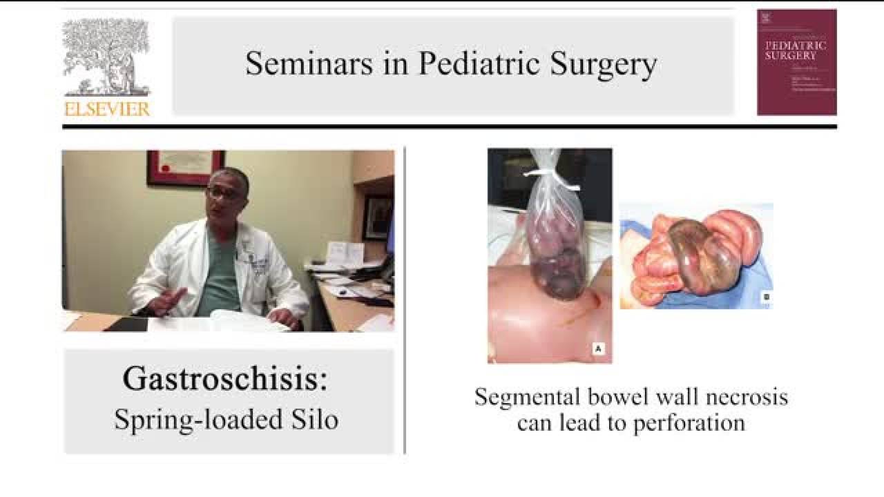 Error Traps and Culture of Safety in Abdominal Wall Defects