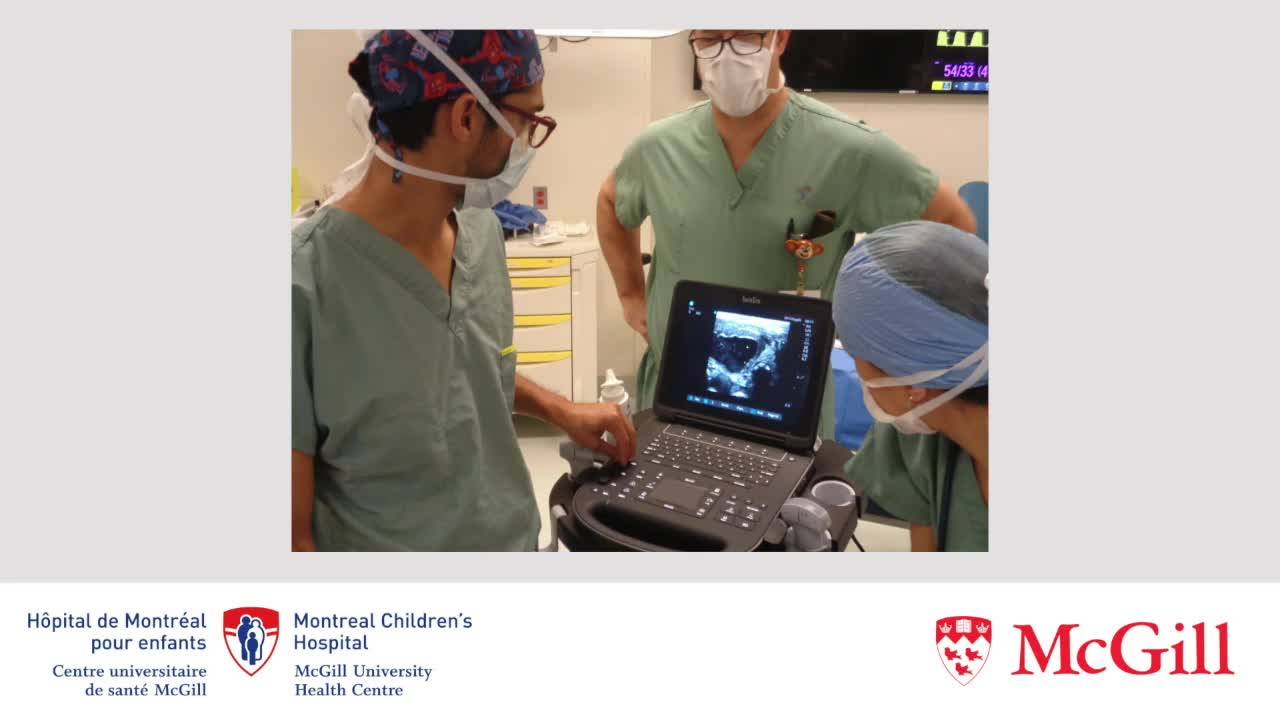 Minimally Invasive Laryngoscopically Assisted Management of an Enlarging...