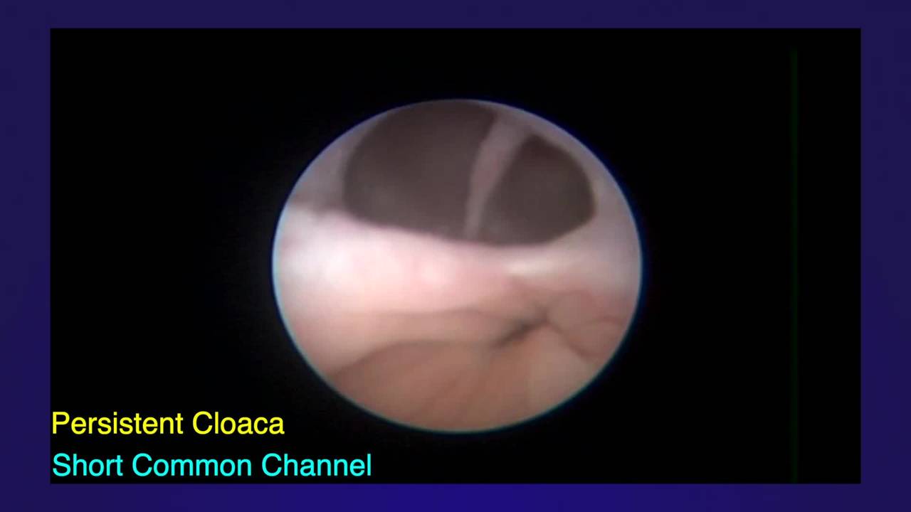 Cloacal Endoscopy