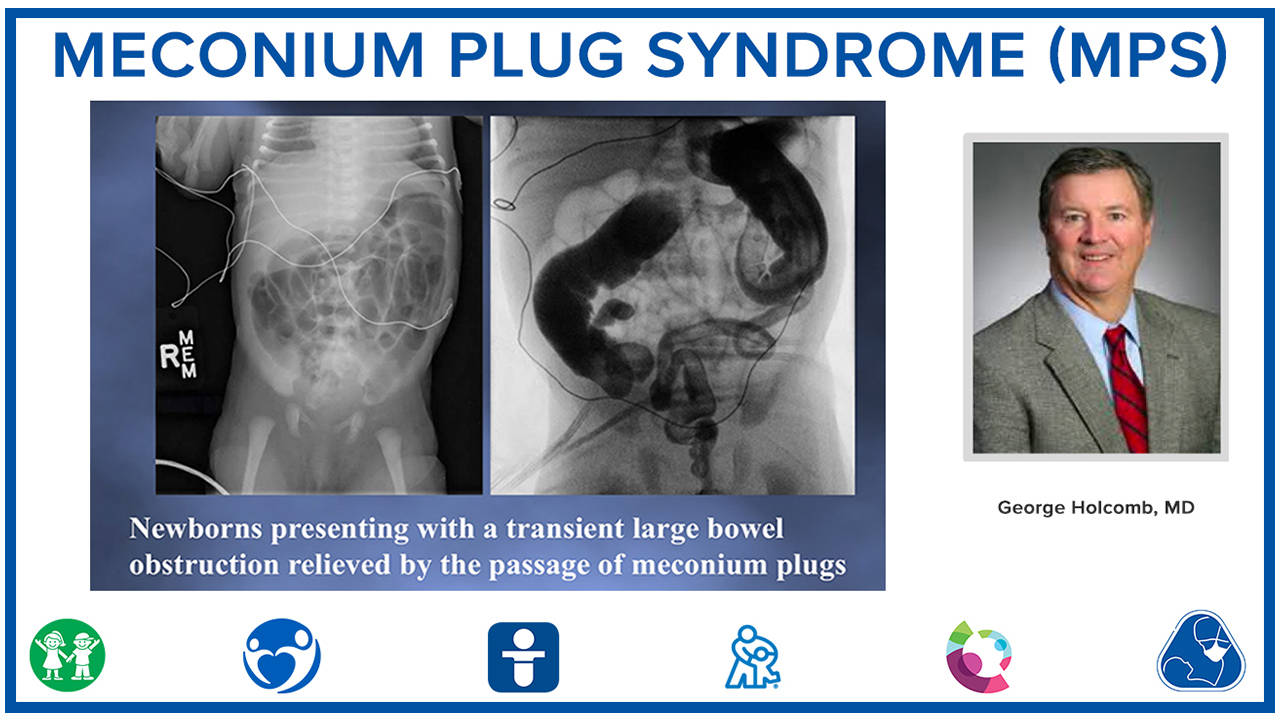 Meconium Plug Syndrome (MPS)