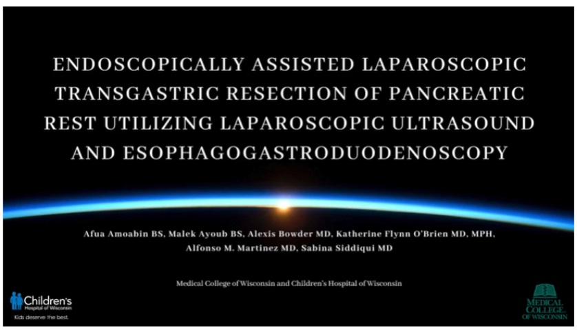 IPEG 2020 TOP ABSTRACT: Endoscopically Assisted Laparoscopic Transgastric Resection of Pancreatic Rest Utilizing Laparoscopic Ultrasound and Esophagogastroduodenoscopy Case Report