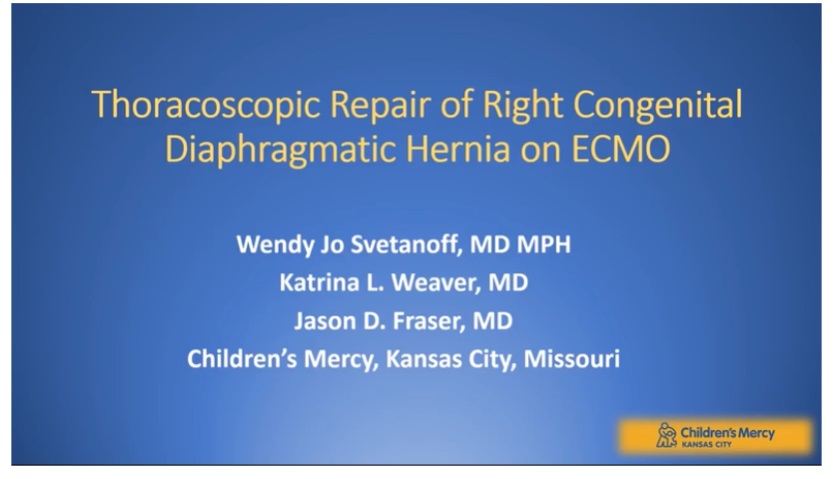 IPEG 2020 TOP ABSTRACT: Thoracoscopic Repair of Right Congenital Diaphragmatic Hernia on ECMO