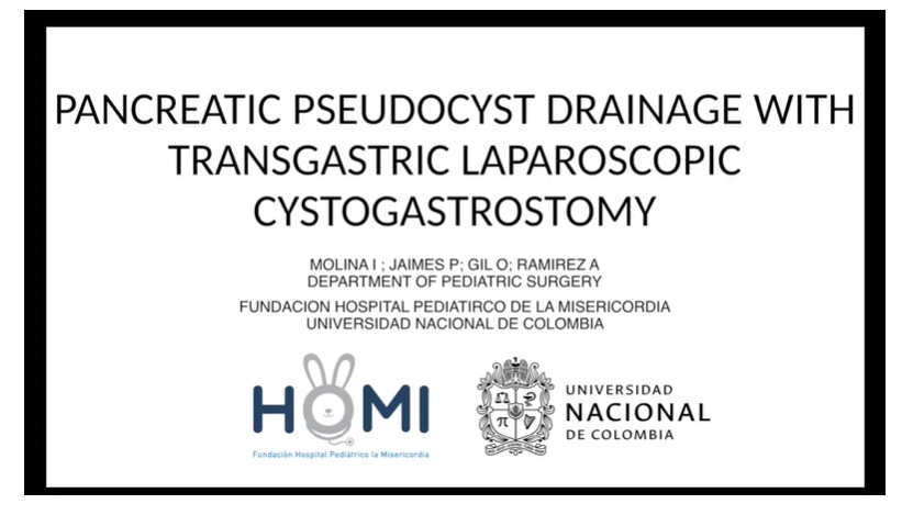 IPEG 2020 TOP ABSTRACT: PSEUDOPANCREATIC CYST DRAINAGE WITH TRANSGASTRIC LAPAROSCOPIC CYSTOGASTROSTOMY