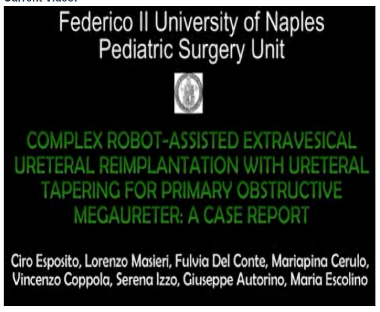 IPEG 2020 TOP ABSTRACT: COMPLEX ROBOT-ASSISTED EXTRAVESICAL URETERAL REIMPLANTATION WITH URETERAL TAPERING FOR PRIMARY OBSTRUCTIVE MEGAURETER: A CASE REPORT