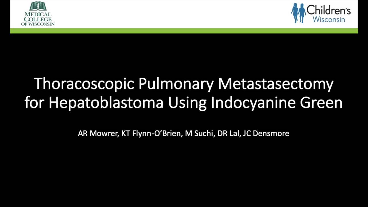 IPEG 2020 TOP ABSTRACT: Thoracoscopic Pulmonary Metastasectomy for Hepatoblastoma Using Indocyanine Green