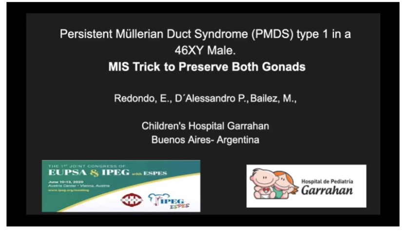 IPEG 2020 TOP ABSTRACT: Persistent Müllerian Duct Syndrome (PMDS) type 1 in a 46XY Male. MIS Trick to Preserve both Gonads