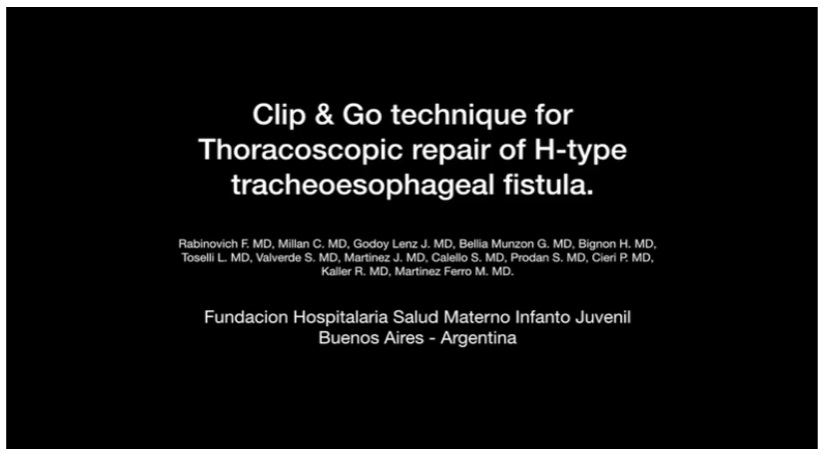 IPEG 2020 TOP ABSTRACT: Clip & Go Technique for thoracoscopic repair of H-type tracheoesophageal fistula.