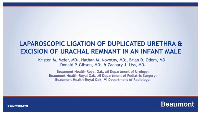 IPEG 2020 Top Abstract: Laparoscopic Ligation of Duplicated Urethra & Excision of Urachal Remnant in an Infant Male