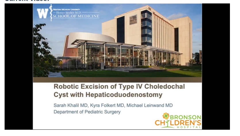 IPEG 2020 Top Abstract: Robotic excision of type IV choledochal cyst with hepaticoduodenostomy