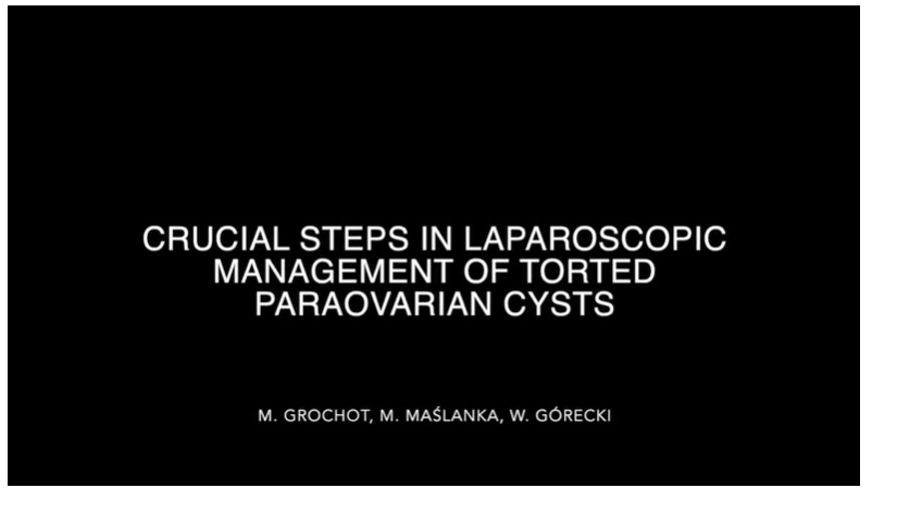 IPEG 2020 TOP ABSTRACT: Crucial steps in in laparoscopic management of torted paraovarian cysts