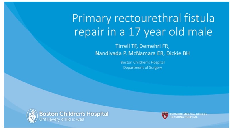 IPEG 2020 TOP ABSTRACT: Primary rectourethral fistula repair in a 17 year old male