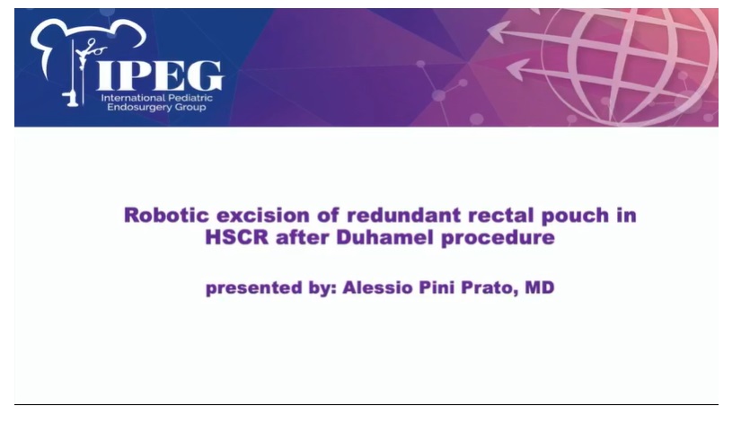 IPEG 2020 TOP ABSTRACT: Robotic excision of redundant rectal pouch in HSCR after Duhamel procedure