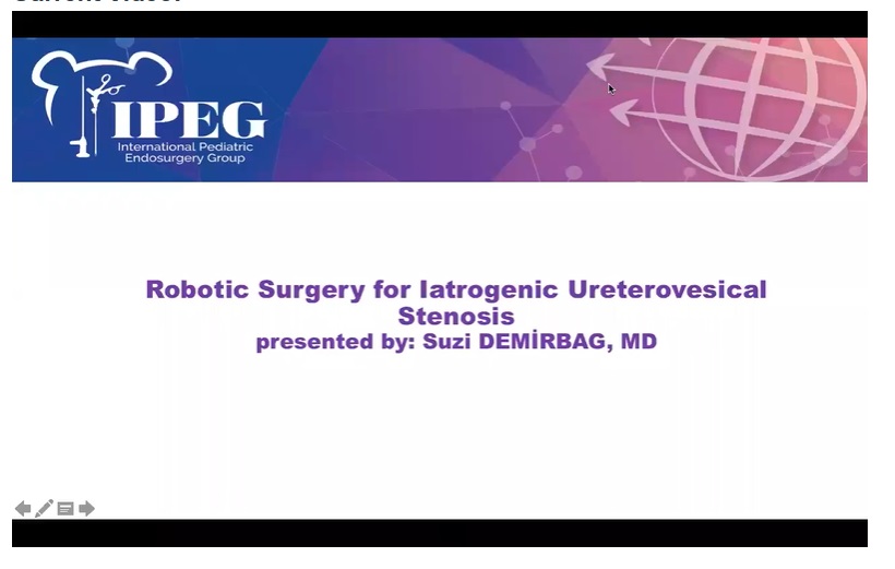 IPEG 2020 TOP ABSTRACT: Robotic Surgery for Iatrogenic Ureterovesical Stenosis