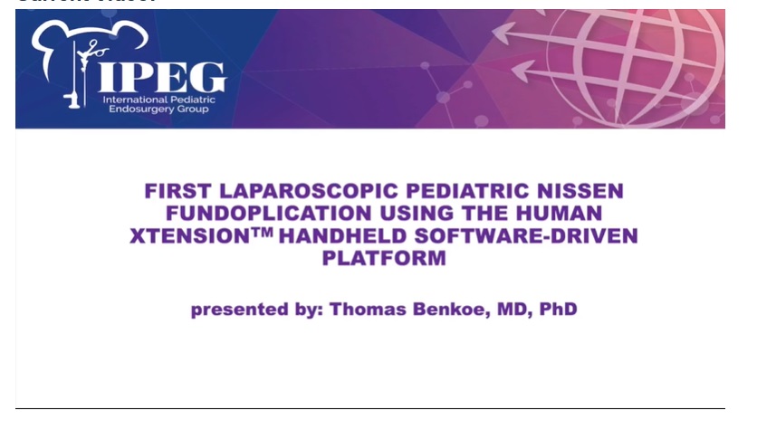 IPEG 2020 TOP ABSTRACT: First Laparoscopic Pediatric Nissen Fundoplication using the Human Xtensions Handheld Software-driven Platform