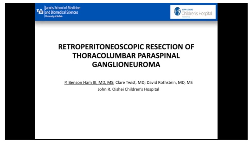 IPEG 2020 TOP ABSTRACT: Retroperitoneoscopic Resection of Thoracolumbar Paraspinal Ganglioneuroma