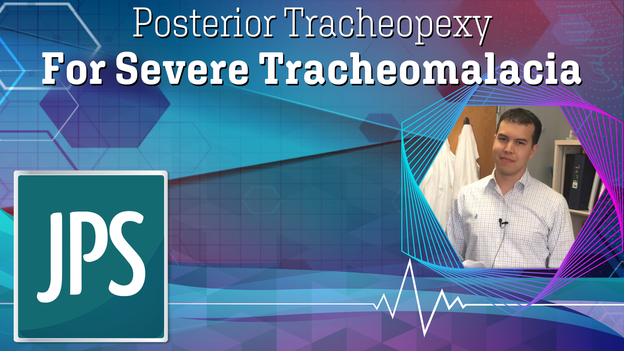 Posterior Tracheopexy For Severe Tracheomalacia