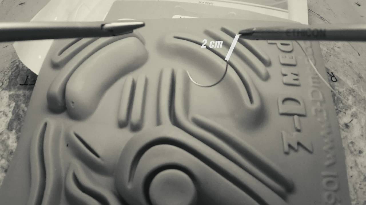 Laparoscopic Skills: Suturing 101