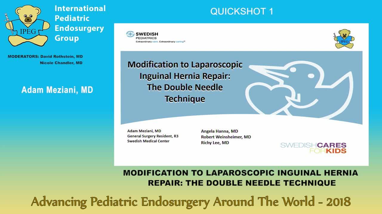 IPEG 2018 - MODIFICATION TO LAPAROSCOPIC INGUINAL HERNIA REPAIR THE DOUBLE NEEDLE TECHNIQUE