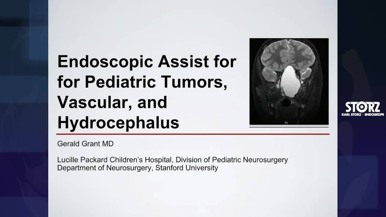 Endoscopic Assist for Pediatric Tumors, Vascular, and Hydrocephalus:...