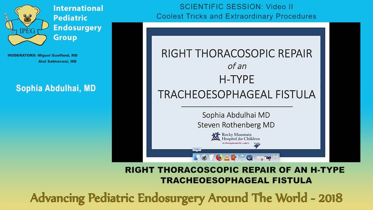 IPEG 2018 - RIGHT THORACOSCOPIC REPAIR OF AN H-TYPE TRACHEOESOPHAGEAL FISTULA