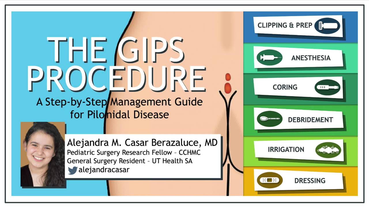 MWPSC Gips Tutorial - APSA 2020 
