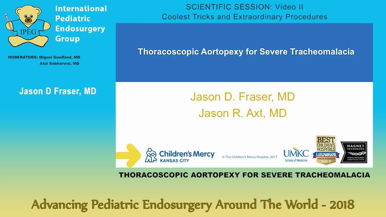 IPEG 2018 - THORACOSCOPIC AORTOPEXY FOR SEVERE TRACHEOMALACIA