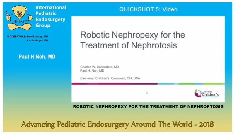 IPEG 2018 - ROBOTIC NEPHROPEXY FOR THE TREATMENT OF NEPHROPTOSIS