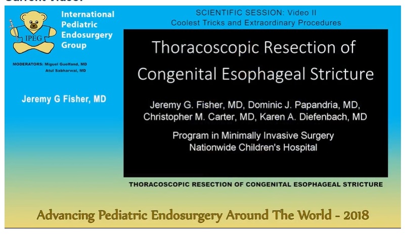 IPEG 2018 - THORACOSCOPIC RESECTION OF CONGENITAL ESOPHAGEAL STRICTURE