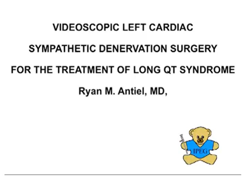 VIDEOSCOPIC LEFT CARDIAC SYMPATHETIC DENERVATION SURGERY FOR THE TREATMENT OF LONG QT SYNDROME