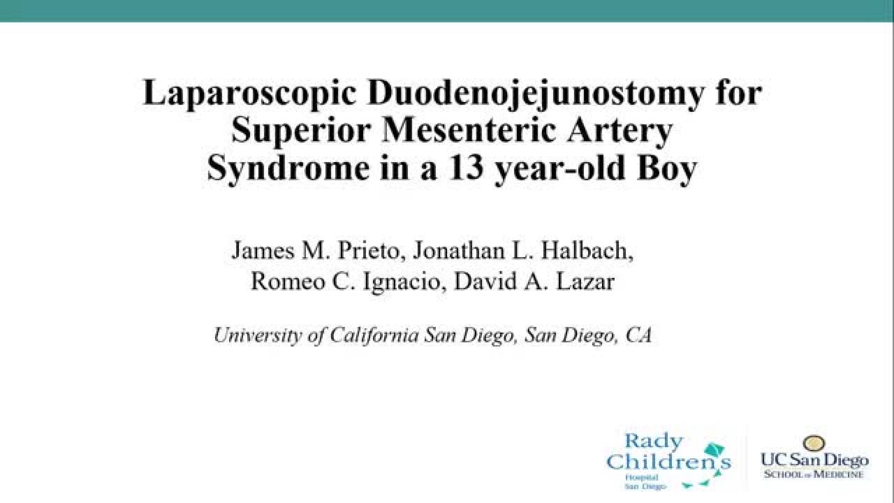 Laparoscopic Duodenojejunostomy for Superior Mesenteric Artery Syndrome (13...