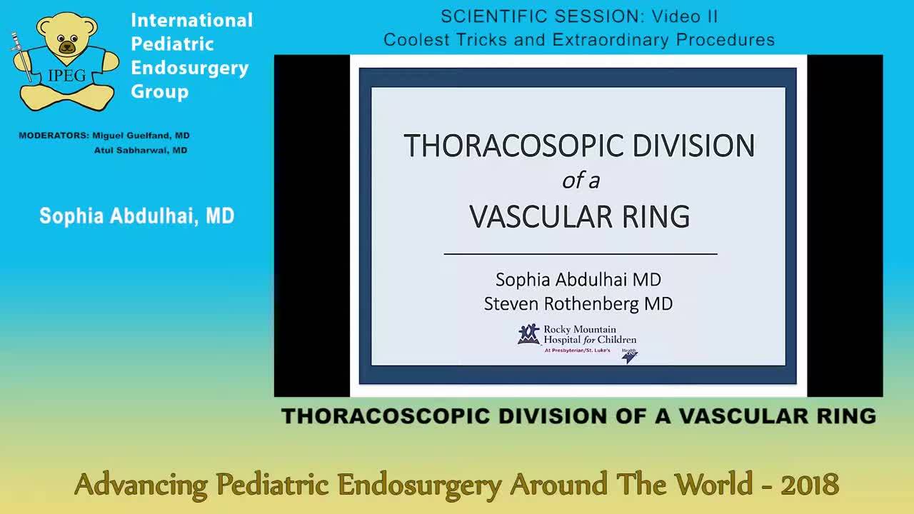 IPEG 2018 - THORACOSCOPIC DIVISION OF A VASCULAR RING