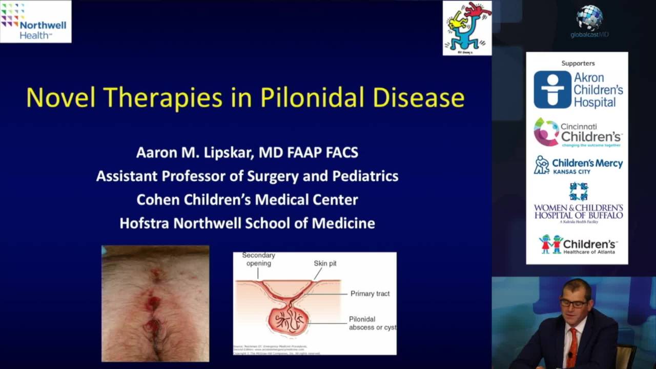 Novel Therapies in Pilonidal Disease: Update Course 2017