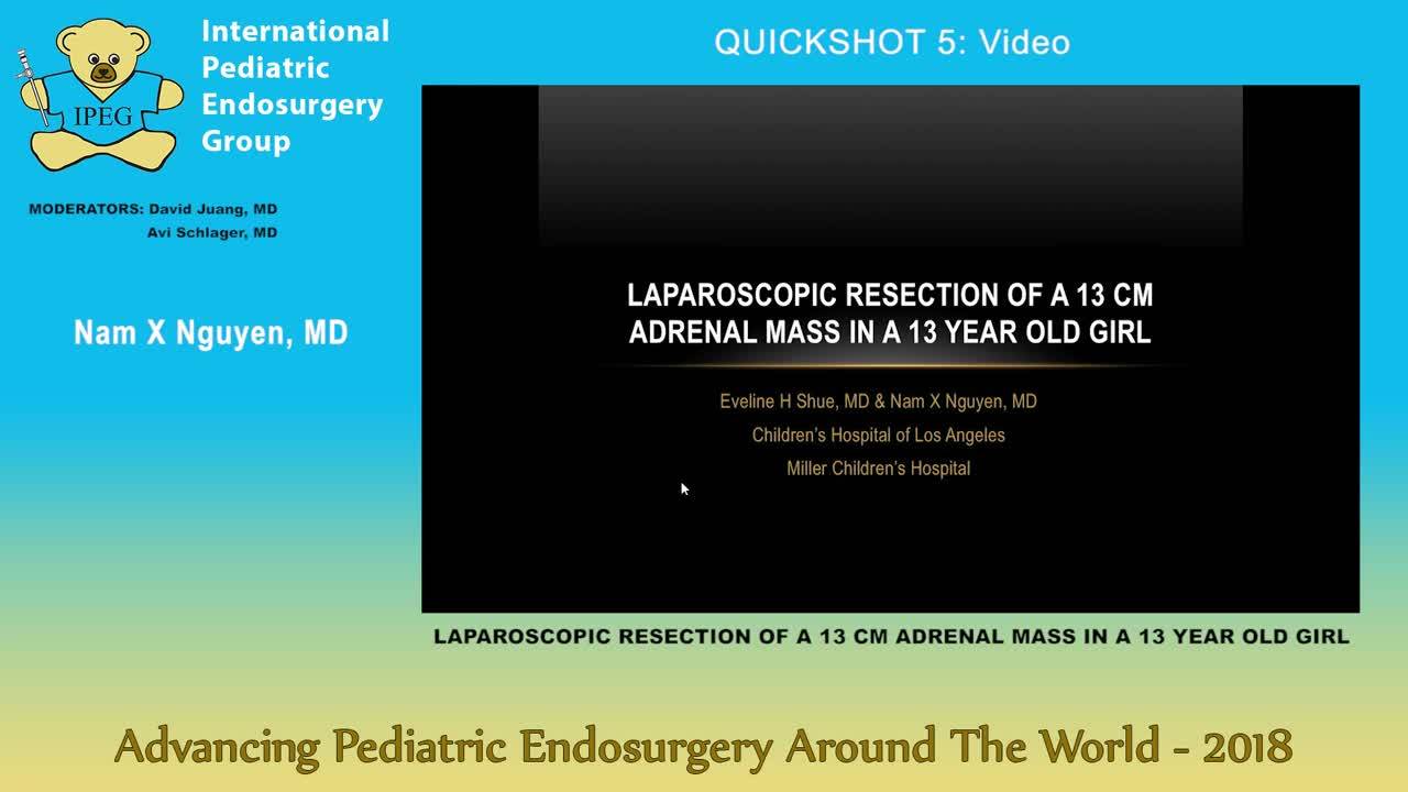 IPEG 2018 - LAPAROSCOPIC RESECTION OF A 13 CM ADRENAL MASS IN A 13 YEAR OLD GIRL