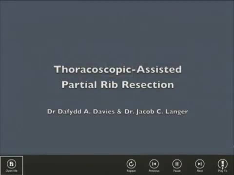 THORACOSCOPIC ASSISTED PARTIAL RIB RESECTION