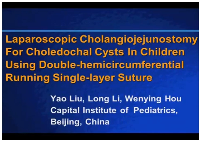LAPAROSCOPIC CHOLANGIOJEJUNOSTOMY FOR CHOLEDOCHAL CYSTS IN CHILDREN USING DOUBLE-HEMICIRCUMFERENTIAL