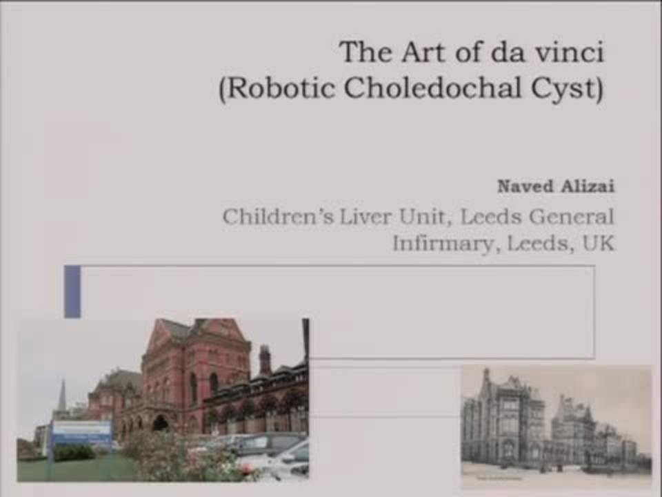 Robotic Hepaticojejunostomy for Choledochal Cyst