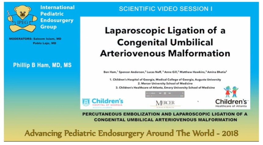 IPEG 2018 - PERCUTANEOUS EMBOLIZATION AND LAPAROSCOPIC LIGATION