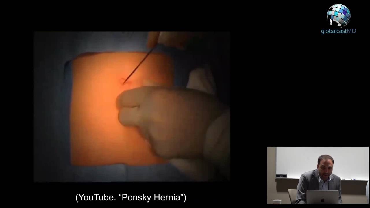 Laparoscopic Pediatric Hernia Repair: Online Course 2017